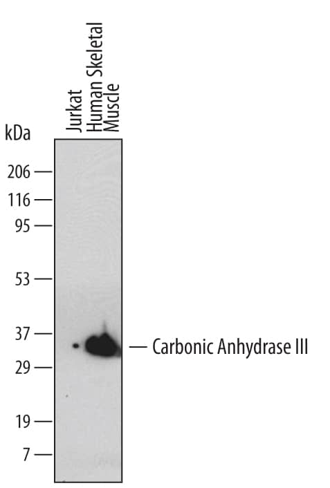 Detection of Human Carbonic Anhydrase III antibody by Western Blot.