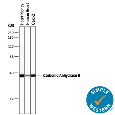 Detection of Human Carbonic Anhydrase II/CA2 antibody by Simple WesternTM.