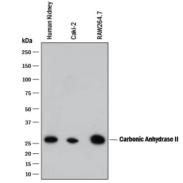 Detection of Human and Mouse Carbonic Anhydrase II/CA2 antibody by Western Blot.