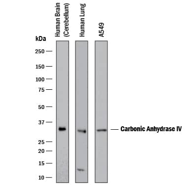 Detection of Human Carbonic Anhydrase IV/CA4 antibody by Western Blot.