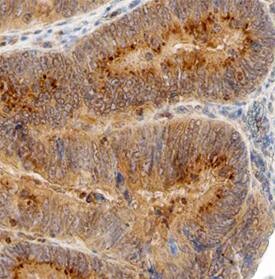 Carbonic Anhydrase IX/CA9 antibody in Human Colon by Immunohistochemistry (IHC-P).