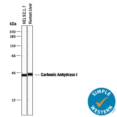 Detection of Human Carbonic Anhydrase I/CA1 antibody by Simple WesternTM.