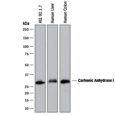 Detection of Human Carbonic Anhydrase I/CA1 antibody by Western Blot.