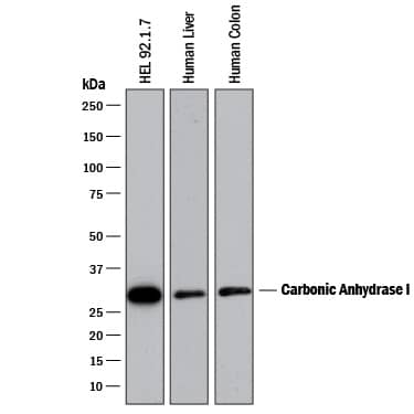 Detection of Human Carbonic Anhydrase I/CA1 antibody by Western Blot.