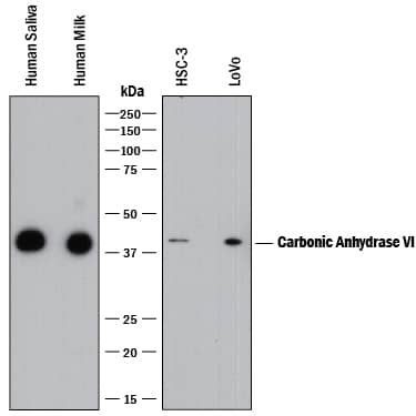 Detection of Human Carbonic Anhydrase VI antibody by Western Blot.