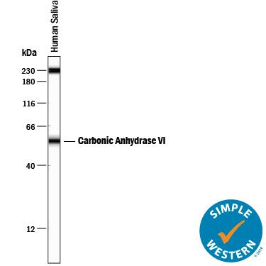 Detection of Human Carbonic Anhydrase VI antibody by Simple WesternTM.