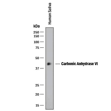 Detection of Human Carbonic Anhydrase VI antibody by Western Blot.