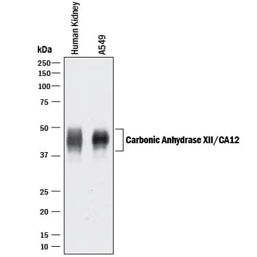 Detection of Human Carbonic Anhydrase XII/CA12 antibody by Western Blot.