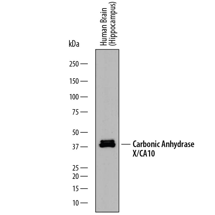 Detection of Human Carbonic Anhydrase X/CA10 antibody by Western Blot.