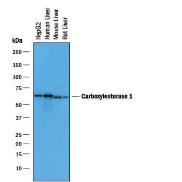 Detection of Human, Mouse, and Rat Carboxylesterase 1/CES1 antibody by Western Blot.