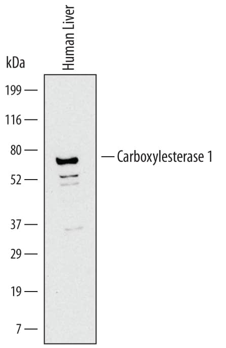 Detection of Human Carboxylesterase 1/CES1 antibody by Western Blot.