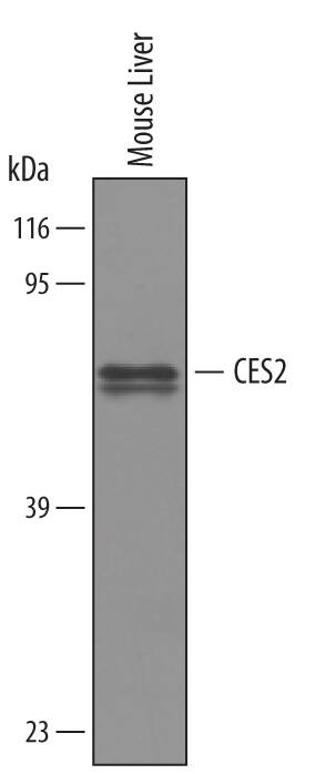 Detection of Mouse Carboxylesterase 2/CES2 antibody by Western Blot.