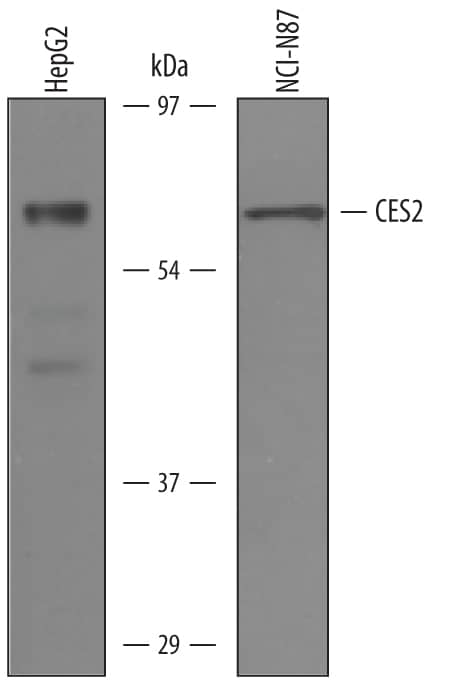 Detection of Human Carboxylesterase 2/CES2 antibody by Western Blot.