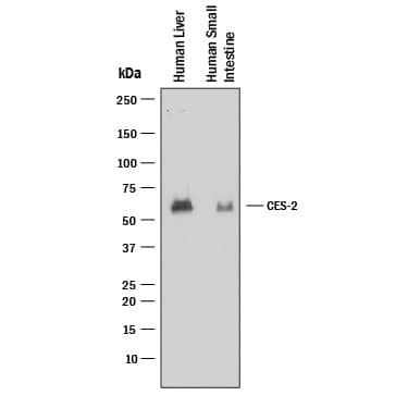 Detection of Human Carboxylesterase 2/CES2 antibody by Western Blot.