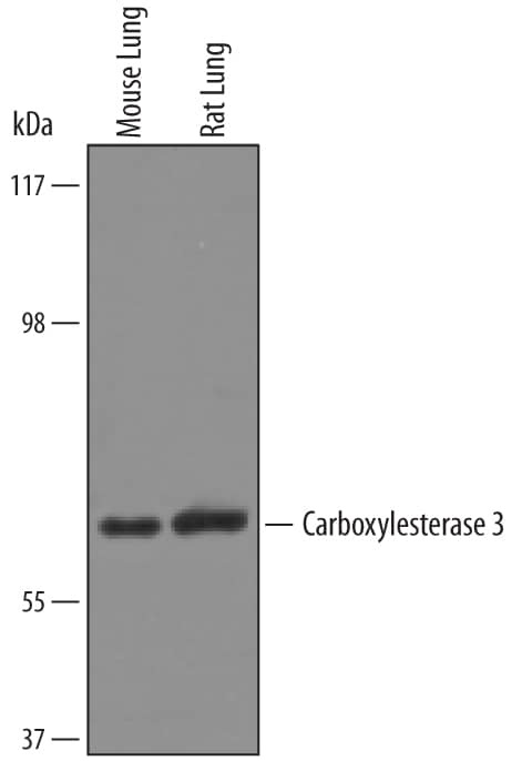 Detection of Mouse and Rat Carboxylesterase 3/CES3 antibody by Western Blot.