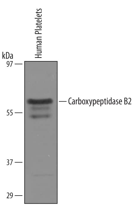 Detection of Human Carboxypeptidase B2/CPB2 antibody by Western Blot.