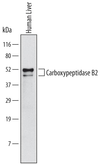 Detection of Human Carboxypeptidase B2/CPB2 antibody by Western Blot.