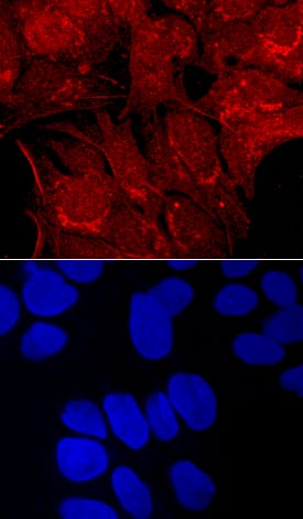 Carboxypeptidase E/CPE antibody in HepG2 Human Cell Line by Immunocytochemistry (ICC).