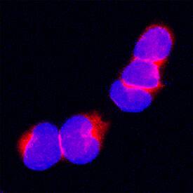 Carboxypeptidase M antibody in THP-1 Human Cell Line by Immunocytochemistry (ICC).