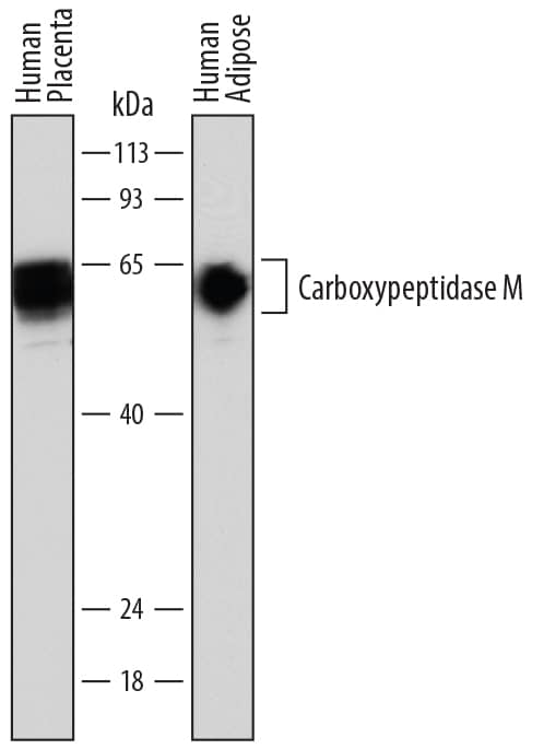 Detection of Human Carboxypeptidase M antibody by Western Blot.