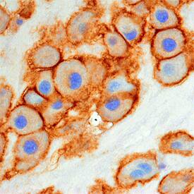 Carboxypeptidase M antibody in Human Placenta by Immunohistochemistry (IHC-P).