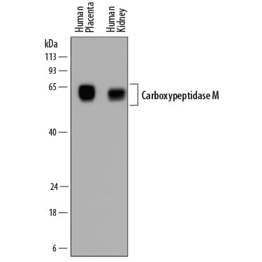 Detection of Human Carboxypeptidase M antibody by Western Blot.