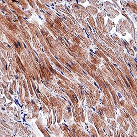 Cardiotrophin-1/CT-1 antibody in Human Heart by Immunohistochemistry (IHC-P).