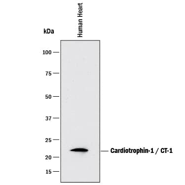 Detection of Human Cardiotrophin-1/CT-1 antibody by Western Blot.