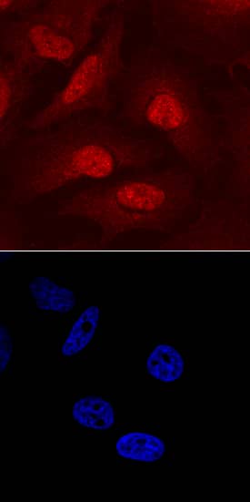 Carm1 antibody in HeLa Human Cell Line by Immunocytochemistry (ICC).