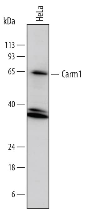 Detection of Human Carm1 antibody by Western Blot.