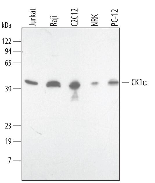 Detection of Human/Mouse/Rat Casein Kinase 1e antibody by Western Blot.