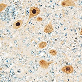 Casein Kinase 2a antibody in Human Brain by Immunohistochemistry (IHC-P).