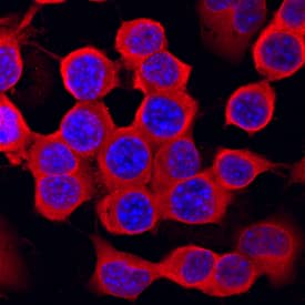 Casein Kinase 2 beta antibody in Neuro-2A Mouse Cell Line by Immunocytochemistry (ICC).