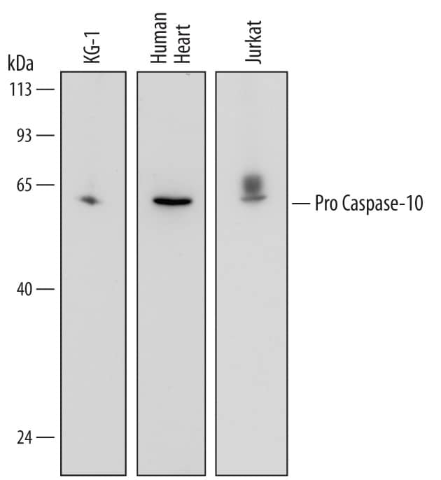 Detection of Human Pro Caspase-10 antibody by Western Blot.