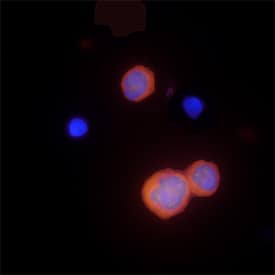 Caspase‑1 in THP‑1 Human Cell Line. Caspase-1 antibody in THP-1 Human Cell Line by Immunocytochemistry (ICC).