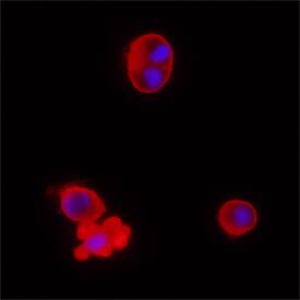 Caspase-2 antibody in Jurkat Human Cell Line by Immunocytochemistry (ICC).