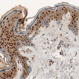 Caspase-14 antibody in Human Epidermis by Immunohistochemistry (IHC-P).