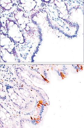 Caspase-3 antibody in Human Colon Using Dual RNAscope®ISH and IHC.