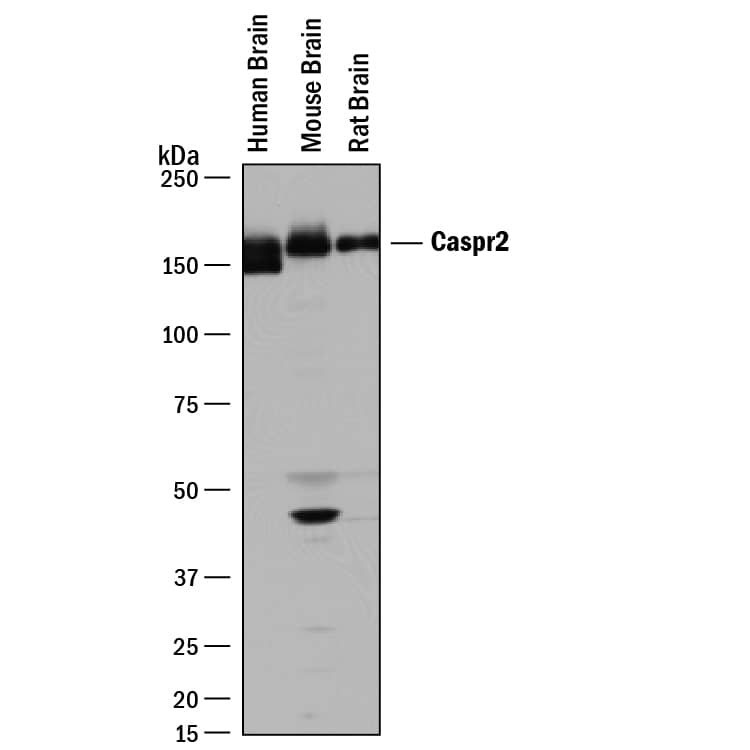 Detection of Human, Mouse, and Rat Caspr2 antibody by Western Blot.