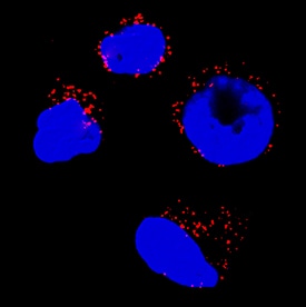 Catalase antibody in HL-60 Human Cell Line by Immunocytochemistry (ICC).