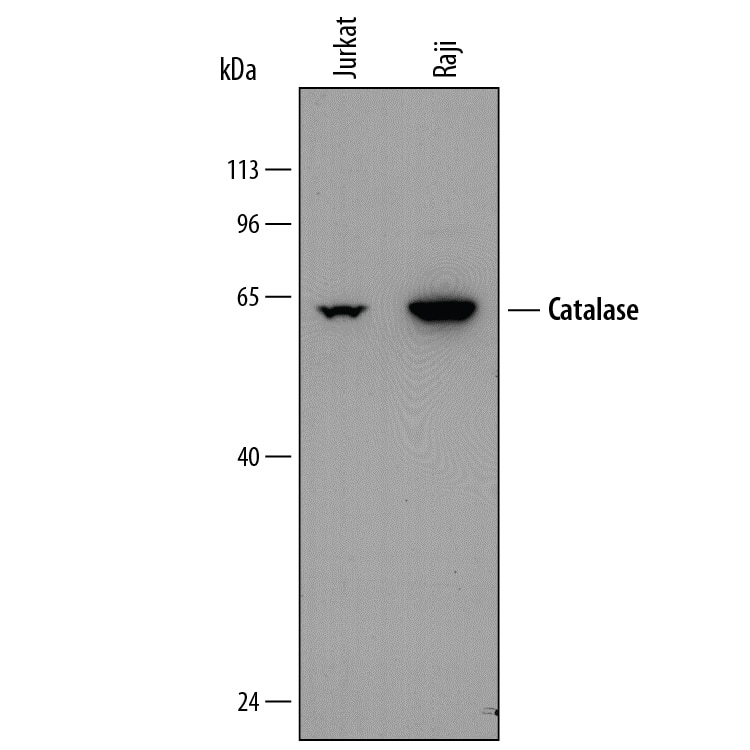 Detection of Human Catalase antibody by Western Blot.