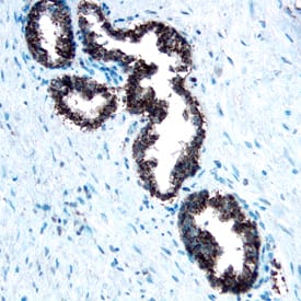 Cathepsin A/Lysosomal Carboxypeptidase A antibody in Human Prostate by Immunohistochemistry (IHC-P).