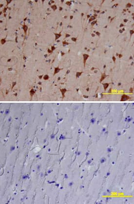 Cathepsin B antibody in Human Brain by Immunohistochemistry (IHC-P).