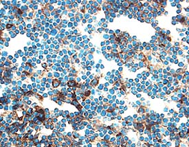 Cathepsin B antibody in Mouse Thymus by Immunohistochemistry (IHC-Fr).