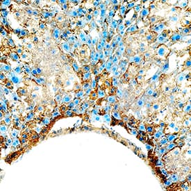 Cathepsin B antibody in Mouse Liver by Immunohistochemistry (IHC-Fr).