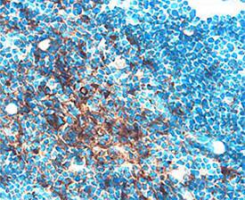 Cathepsin C/DPPI antibody in Mouse Thymus by Immunohistochemistry (IHC-Fr).