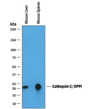 Detection of Mouse Cathepsin C/DPPI antibody by Western Blot.