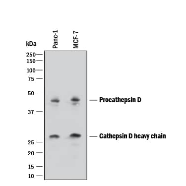 Detection of Human Cathepsin D antibody by Western Blot.