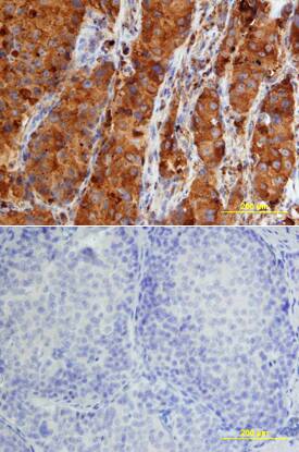 Cathepsin D antibody in Human Lung by Immunohistochemistry (IHC-P).