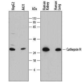 Detection of Human Cathepsin H antibody by Western Blot.